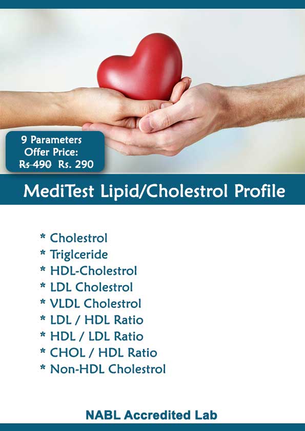 Lipid Profile Test Cost In Delhi NCR Noida Rs 290 Gurgaon Punjab