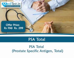 PSA Total Prostate Test cost in Delhi NCR Noida @Rs 299 Gurgaon