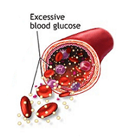 blood glucose
